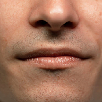 Depilación Hombre Bigote