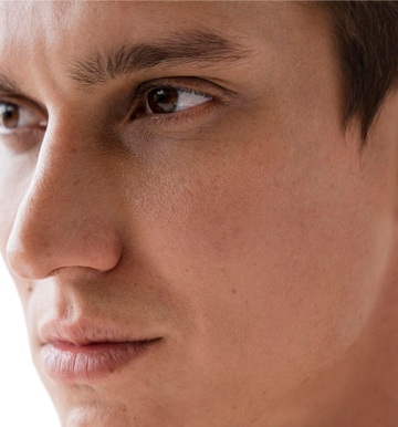 Depilación Hombre Pómulos/Mejillas
