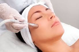 Microdermoabrasión Facial Superfacial